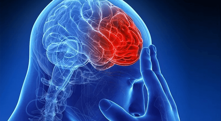 A stroke takes place where the blood supply to the brain stops taking place.